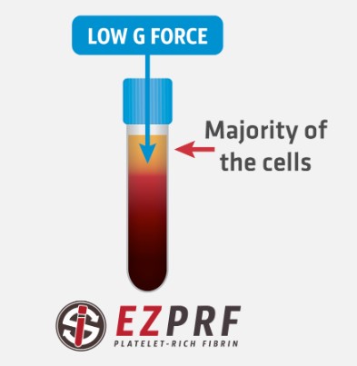 ez gel prf platelet rich fibrin supplier